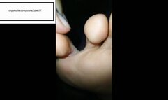 Caribean_feet11 Athletes foot inspection