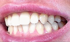 deep pink slobbery throat