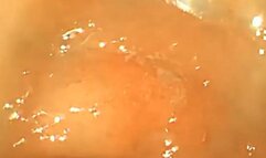 The doctor explores my belly full of meat to digest - FullScreen Exploration 720HD