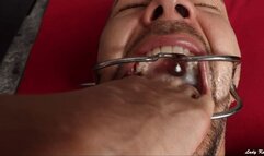 Painfull & Brutal Wiggling In Your Throat from Close Distance (1080 HD)