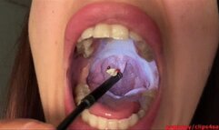 Oral inspection, DEVOURE swallow him