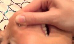 NOSE ATTACK-PART 1 WMV