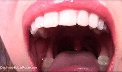 854x480p * A Little Pest Stuck in My Mouth -Mp4