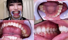 Sakura Kurumi - Watching Inside mouth of Japanese cute girl