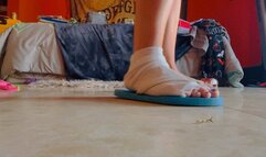 Flip-flops, dirty feet, and injured ankle