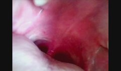 Endoscope of my Mouth