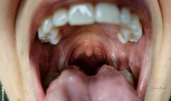 Mouth open swallow explaination