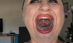 Finger on uvula ORDER a