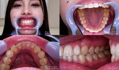 Mai Arisu - Watching Inside mouth of Japanese cute girl - MOV 1080p