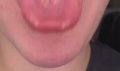 Large Tongue and Throat