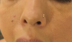 ORAL EXAMINATION | Yuzu