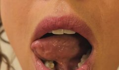 ORAL EXAMINATION {SECOND INSPECTION} | Yuzu