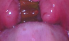 Endoscope Gummy Gulp 2
