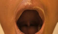 ORAL EXAMINATION | Morgan
