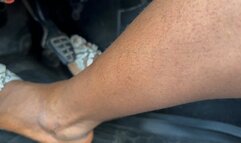 Car Sputtering BLUES In My Wedges