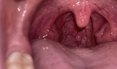 MOUTH TOUR FLASH ON DEEP INSIDE MY MOUTH