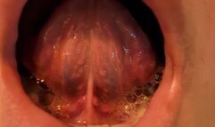 ORAL EXAMINATION {X925-OM ANALYSIS} | Marilyn