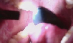 J'avale la télécommande de mon vibromasseur une tête de figurine est un faux serpent =)