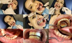 Dental examination and rough cleaning with a manual scaler