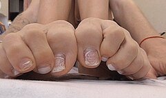 Terrible scabby toes! MP4