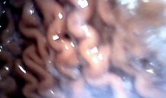 whole hotodogs in stomach