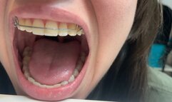 Climb into cute giantess's retainer mouth