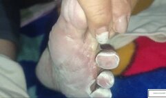 Mila1 Mom lets you inspect her athletes foot once again