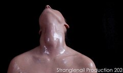 Larissa's oily throat presentation