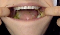 White fangs crunching pickles