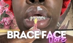 Brace Face Vore