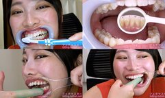 Miki Sunohara - Observing Sunohara Miki's teeth with a dental mirror & brushing her teeth while wearing a mouth opener & finger toothbrushing while wearing a lip hook