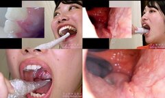 Miki Sunohara - Observing Sunohara Miki's teeth, mouth, and back of the throat with a dental camera - MOV 1080p