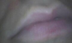 Marylin Endoscopic Snack