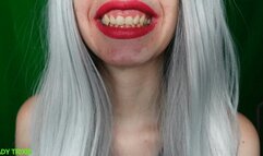 My teeth are chattering -pt10