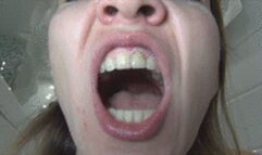 Dirty teeth and bad breath