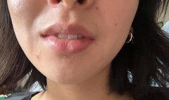 Aurora’s Teeth Get A New Look