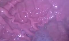 Carolyns First Endoscope Clip!