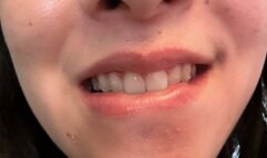 Aurora’s Sexy Teeth Strike Again