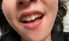 Aurora Shines Her Beautiful Teeth For You