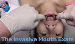 The Invasive Mouth Exam