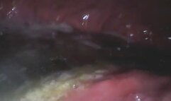 Carolyns Gummy Worms