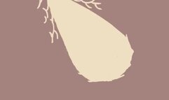 Leaf's Beedrill - W.T. Dinner (Character 18+)