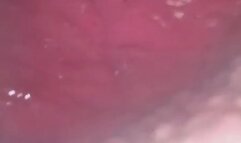 Carolyn: Fully Digested Tacos