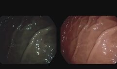 A longer trip, you won´t escape!!!