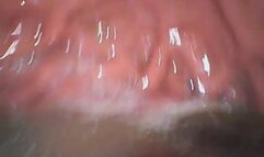 Sloane: Digesting Gummy Worms