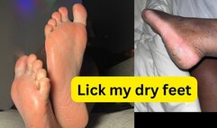 Suck my dry toes, lick my dry feet & cracked heels