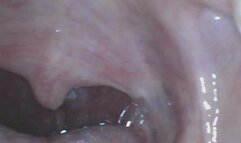 Trina: Endoscope Mouth Tour