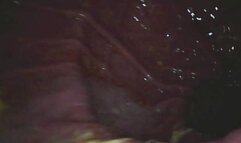 Carolyn: Cheezit In My Gut