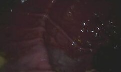 Carolyn:Cheezit in my Gut