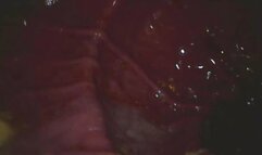 Carolyn:Cheezits in my Gut